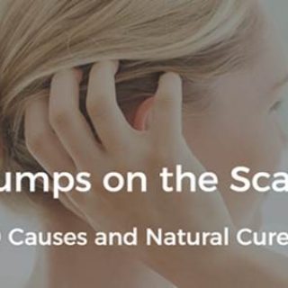 Bumps on scalp
