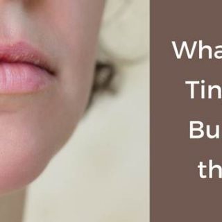 Bumps on Lips