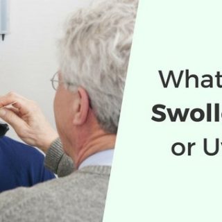 Swollen Uvula