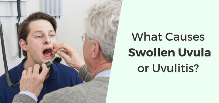 Swollen Uvula