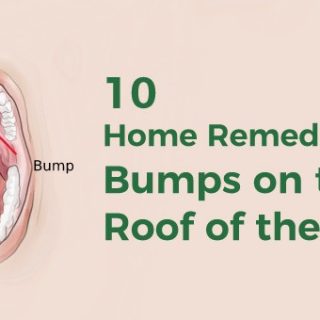 bumps on roof of mouth