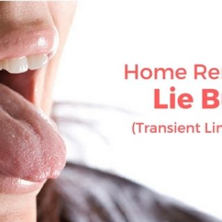 Lie Bumps Home Remedies