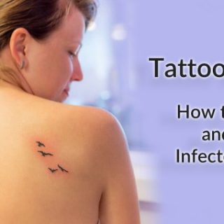 Infected tattoo