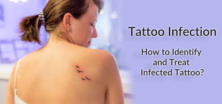 Infected tattoo