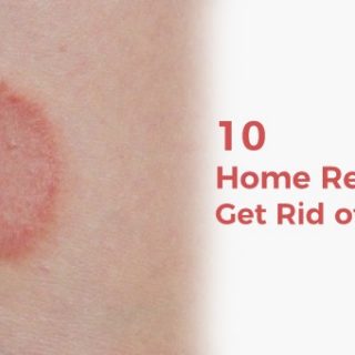 How to get rid of ringworm