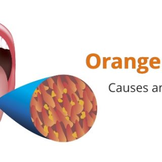 Orange tongue