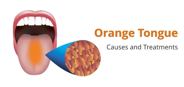 Orange tongue
