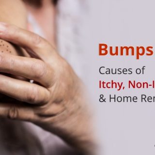 Bumps on elbows