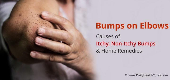 Bumps On Elbows Causes Of Itchy And Non Itchy Bumpstreatment Options