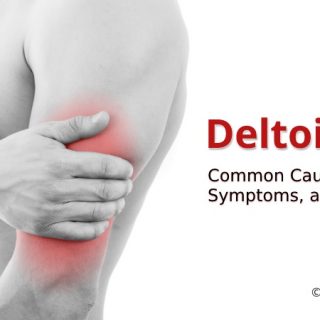 Deltoid pain