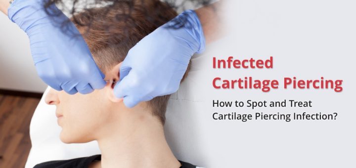 infected ear piercing