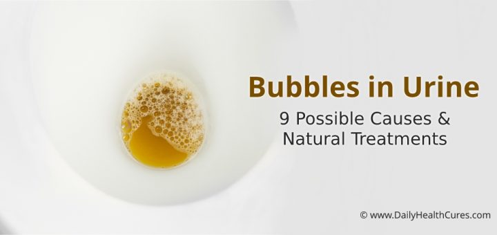 Bubbles in urine