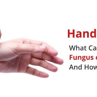 Fungus on fingers