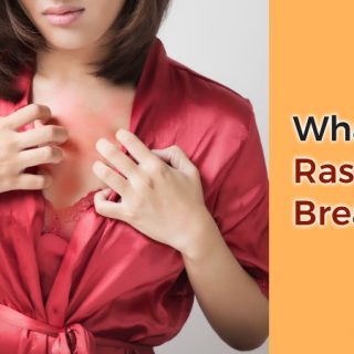 Rash between breasts