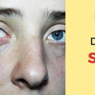How long does a stye last