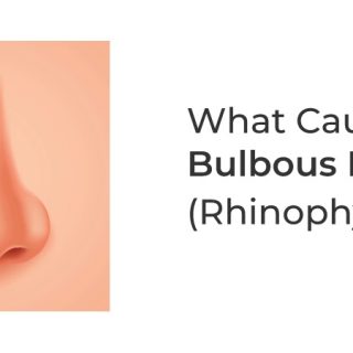 Bulbous Nose