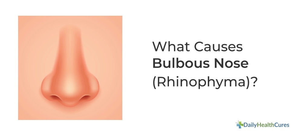Bulbous Nose