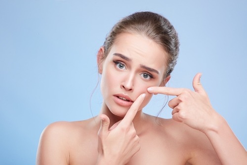 blind pimple treatment home remedies