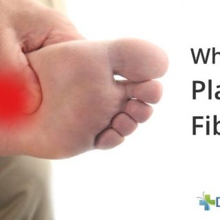 Plantar fibroma