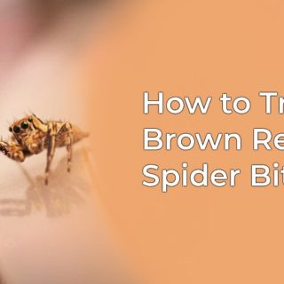 Brown recluse spider bite treatment