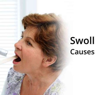 Swollen Throat