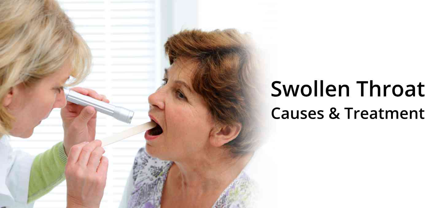 Swollen Throat