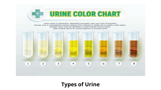 Oily Urine: Causes, Symptoms and Treatment | 