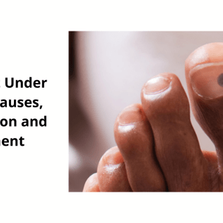 black spot under toenail