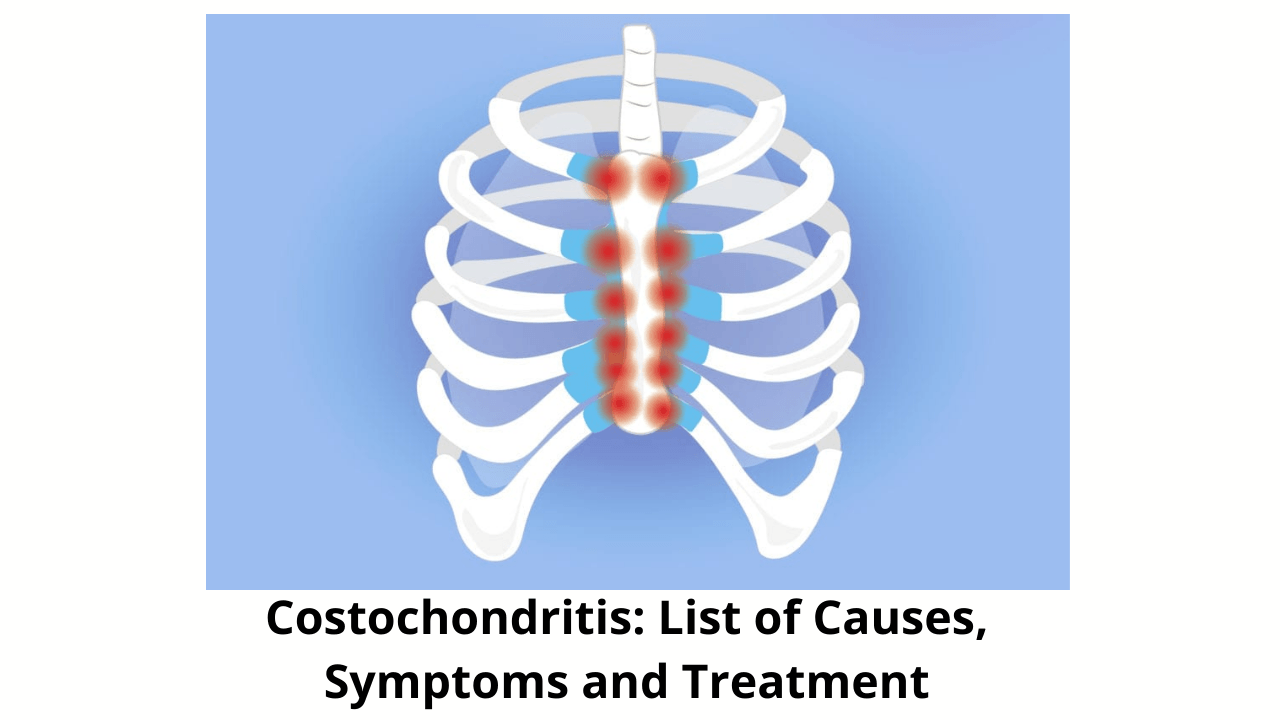 costochondritis