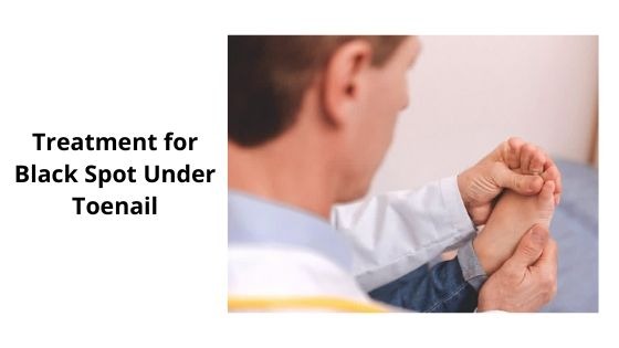 treatment for black spot under toe nail