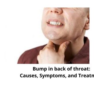 Bump in back of throat
