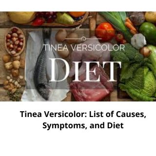 Tinea Versicolor diet