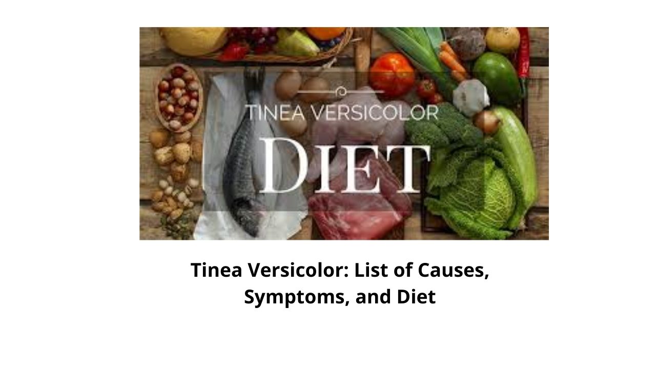 Tinea Versicolor diet