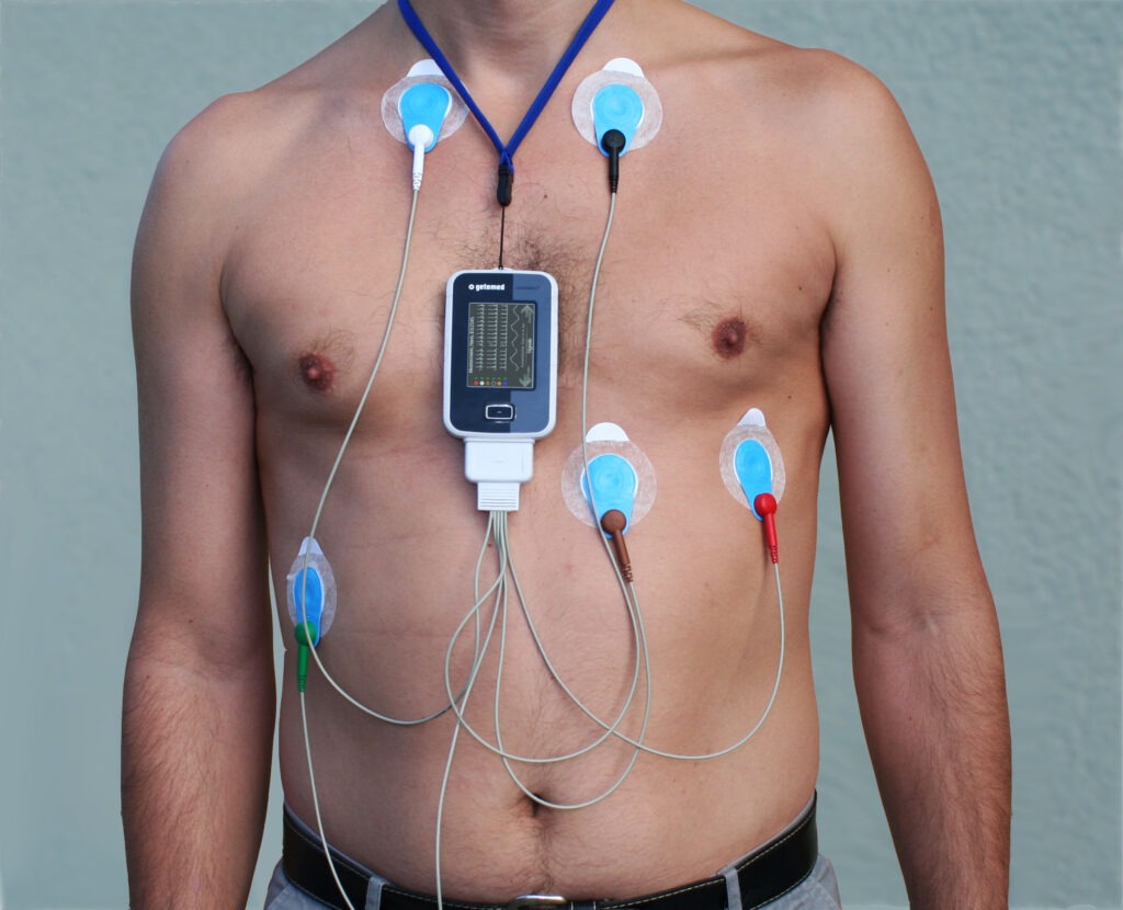 ECG